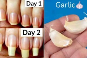 How To Grow Nails Faster Home Remedies