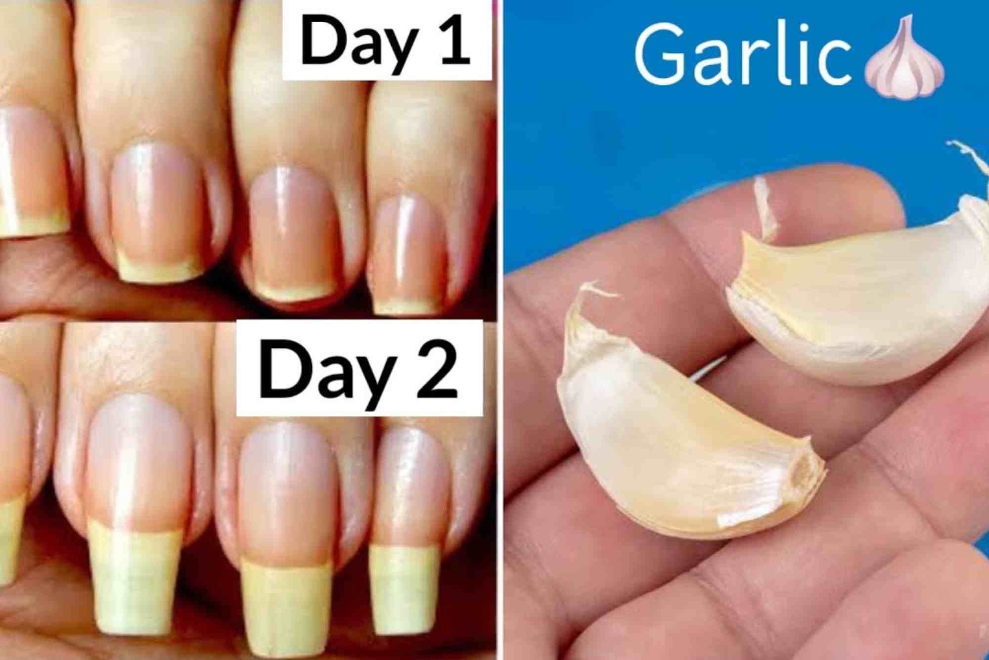 How To Grow Nails Faster Home Remedies